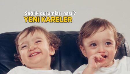 Yasemin Şefkatli’nin 1 yaşındaki ikizleri ameliyat oldu! Sıhhat durumlarını paylaştı