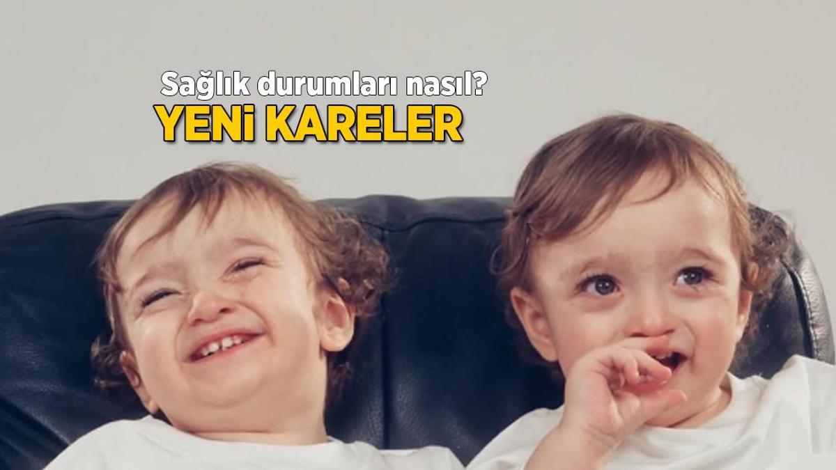 Yasemin Şefkatli’nin 1 yaşındaki ikizleri ameliyat oldu! Sıhhat durumlarını paylaştı