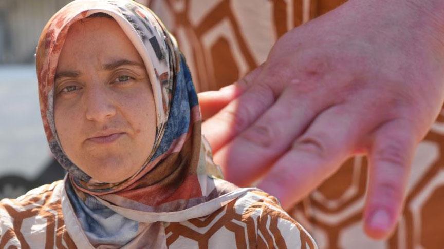 10 kişinin canını yaktı son kurbanı Şükran oldu! ‘O anı hatırlıyorum’