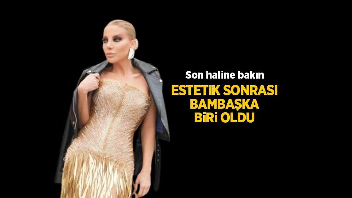 Bıçak altına yatan Gülşah Saraçoğlu değişik biri oldu! Estetik sonrası son haline bakın