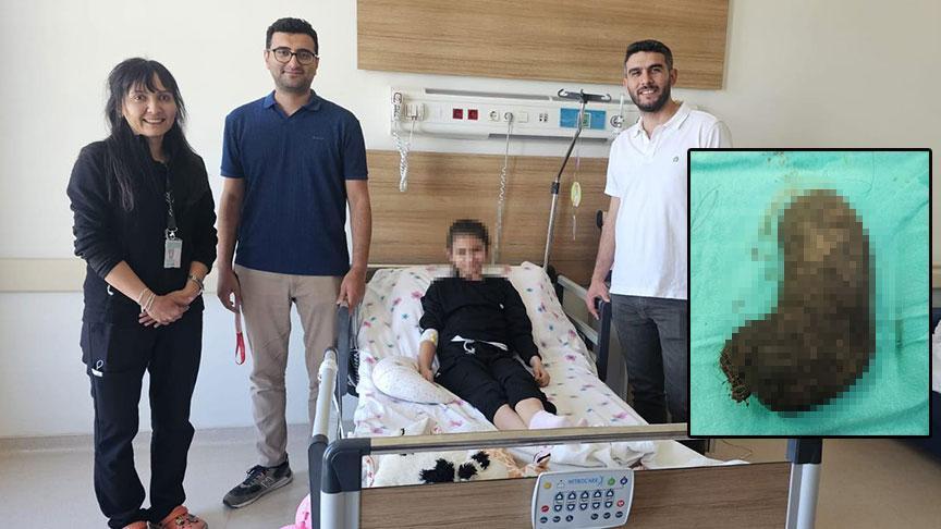 Bulantı ve iştahsızlık şikayetiyle gitti! 9 yaşındaki kızın midesinden çıkanlar şaşkına çevirdi